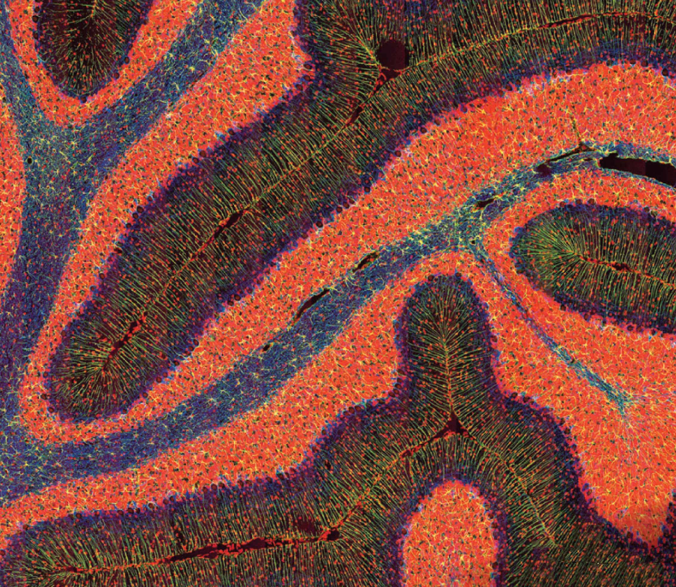 В определённых условиях мозг удивительно хорошо поддаётся сохранению. На микрофотографии показан фрагмент мозжечка.