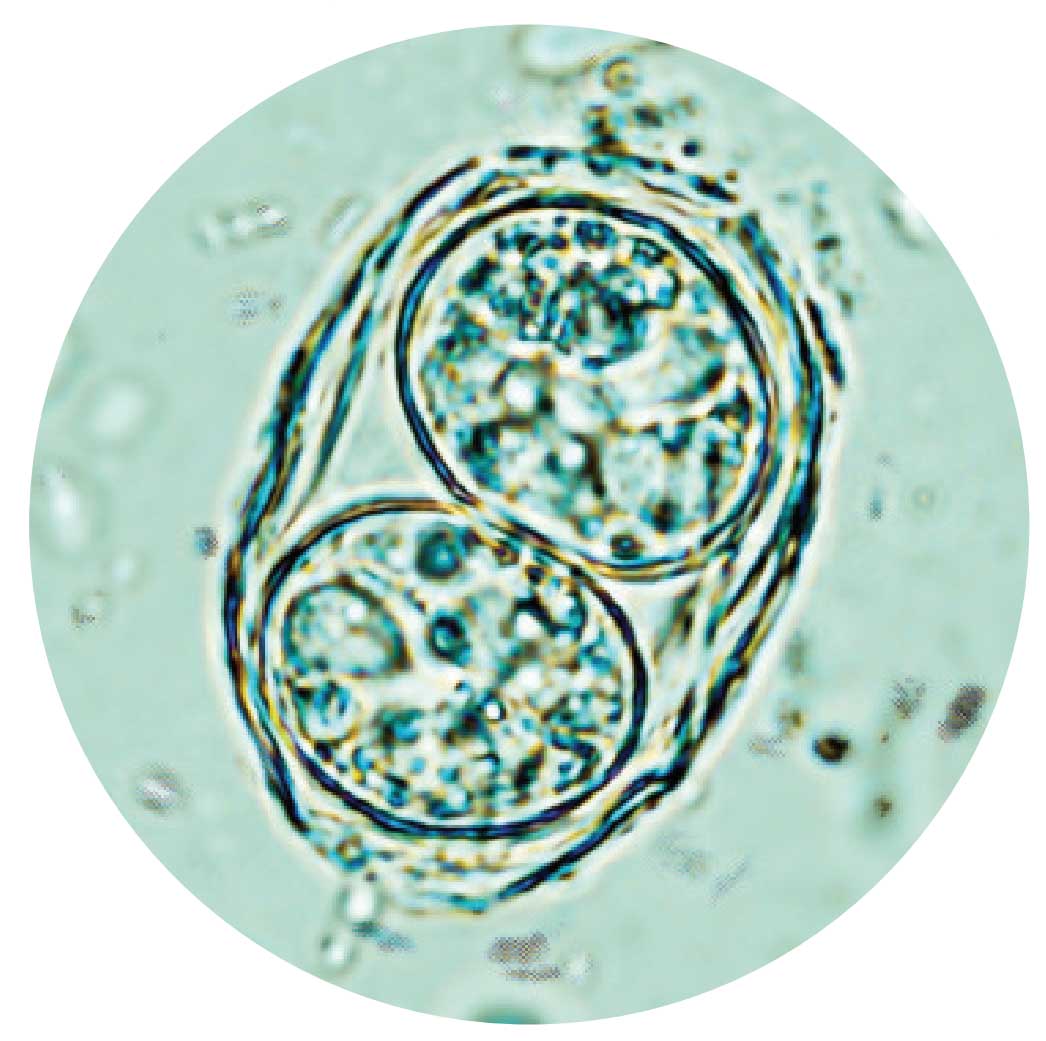 Учёные надеются однажды «укротить» смертельно опасного паразита, чтобы использовать его для доставки лекарств в мозг людей с неврологическими заболеваниями.